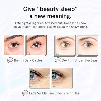 Grace & Stella Under Eye Patches for Puffy Eyes and Dark Circles